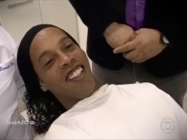 Ronaldinho tem um novo sorriso